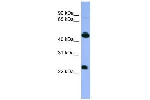 WB Suggested Anti-OPN1MW Antibody Titration: 0. (OPN1MW antibody  (C-Term))