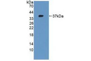 Detection of Recombinant KRT10, Human using Polyclonal Antibody to Cytokeratin 10 (CK10) (Keratin 10 antibody  (AA 153-456))