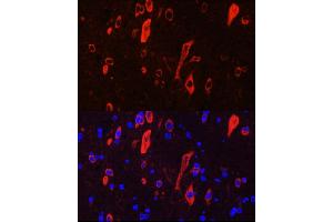 Immunofluorescence analysis of rat brain cells using NTRK3 Rabbit pAb (ABIN6132429, ABIN6144910, ABIN6144912 and ABIN6221540) at dilution of 1:100 (40x lens). (NTRK3 antibody  (AA 40-300))