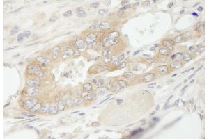 Immunohistochemistry (IHC) image for anti-Eukaryotic Translation Elongation Factor 1 gamma (EEF1G) (AA 200-250) antibody (ABIN7448955) (EEF1G antibody  (AA 200-250))