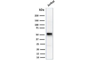 Western Blot Analysis of human Jurkat cell lysate using Cyclin E Mouse Monoclonal Antibody (CCNE1/2460).
