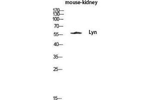 Western Blot (WB) analysis of Mouse Kidney lysis using Lyn antibody. (LYN antibody  (Ser78))