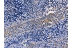 ABIN6256169 and ABIN6267274 at 1/100 staining human normal tonsil tissue by IHC-P.