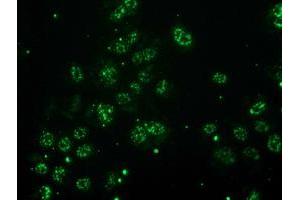 Anti-MGLL mouse monoclonal antibody (ABIN2454561) immunofluorescent staining of COS7 cells transiently transfected by pCMV6-ENTRY MGLL (RC218358). (MGLL antibody)