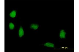 Immunofluorescence of purified MaxPab antibody to FOXP3 on HeLa cell. (FOXP3 antibody  (AA 1-431))