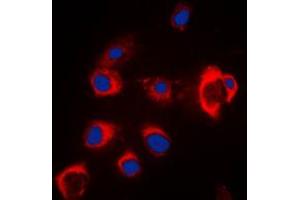 Immunofluorescent analysis of ZIP7 staining in MCF7 cells. (SLC39A7 antibody  (Center))