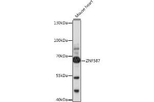 Western blot analysis of extracts of mouse heart, using ZNF587 antibody (ABIN7271507) at 1:1000 dilution. (ZNF587 antibody  (AA 120-240))