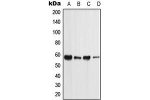 Western blot analysis of PIGW expression in MCF7 (A), NTERA2 (B), Raw264.