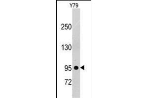 Western blot analysis of anti-PDGFRB Pab (ABIN392036 and ABIN2841804) in Y79 cell line lysates (35 μg/lane). (PDGFRB antibody)