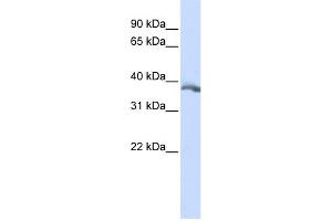 WB Suggested Anti-EDA Antibody Titration:  0. (Ectodysplasin A antibody  (Middle Region))