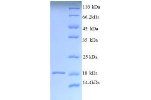 SDS-PAGE (SDS) image for Angiogenin (ANG) (AA 24-148) protein (His tag) (ABIN4975210)
