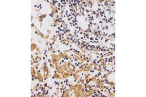 (ABIN652075 and ABIN2840539) staining CUX1 in human lymph node tissue sections by Immunohistochemistry (IHC-P - paraformaldehyde-fixed, paraffin-embedded sections).