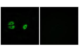 Immunofluorescence analysis of A549 cells, using MRPS22 antibody. (MRPS22 antibody  (Internal Region))