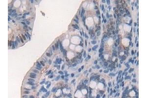 Immunohistochemistry (IHC) image for anti-Glutathione Reductase (GSR) (AA 240-500) antibody (ABIN7442147)