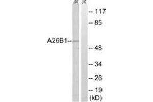 Western blot analysis of extracts from Jurkat cells, using A26B1 Antibody. (POTEB antibody  (AA 481-530))