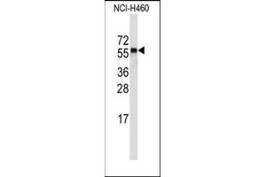 Image no. 1 for anti-Cytochrome P450, Family 4, Subfamily A, Polypeptide 11 (CYP4A11) (C-Term) antibody (ABIN360251) (CYP4A11 antibody  (C-Term))