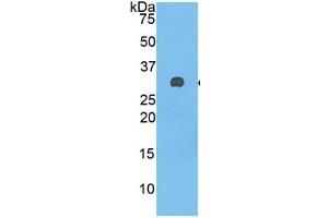 WB of Protein Standard: different control antibodies against Highly purified E. (Complement Factor H ELISA Kit)
