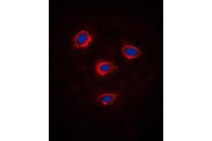 Immunofluorescent analysis of Frizzled 8 staining in Jurkat cells. (FZD8 antibody  (C-Term))