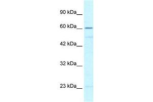 Human Jurkat; WB Suggested Anti-ZNF212 Antibody Titration: 0.