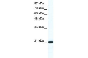 WB Suggested Anti-RAXL1 Antibody Titration:  1. (RAX2 antibody  (N-Term))