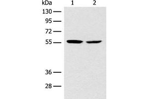 Western blot analysis of Mouse brain tissue NIH/3T3 cell lysates using CORO2B Polyclonal Antibody at dilution of 1:1000 (CORO2B antibody)