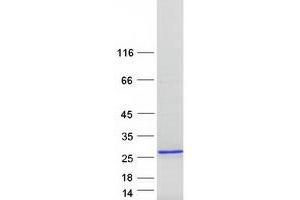 Validation with Western Blot (TNNI2 Protein (Transcript Variant 1) (Myc-DYKDDDDK Tag))