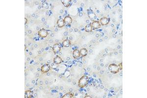 Immunohistochemistry of paraffin-embedded mouse kidney using NOD1 antibody (ABIN3021837, ABIN3021838, ABIN3021839 and ABIN6216095) at dilution of 1:100 (40x lens). (NOD1 antibody  (AA 1-270))