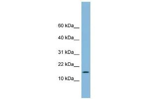 UBE2L6 antibody used at 1 ug/ml to detect target protein. (UBE2L6 antibody  (Middle Region))