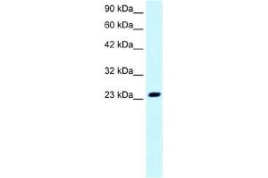 Human Jurkat; WB Suggested Anti-FLJ11730 Antibody Titration: 0. (MEAF6 antibody  (N-Term))