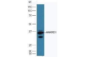 Mouse heart lysates probed with Rabbit Anti-ANKRD1 Polyclonal Antibod, Unconjugated  at 1:5000 90min in 37˚C. (ANKRD1 antibody  (AA 185-319))