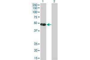 Western Blot analysis of NKX2-5 expression in transfected 293T cell line by NKX2-5 monoclonal antibody (M03), clone 3A7. (NK2 Homeobox 5 antibody  (AA 1-130))