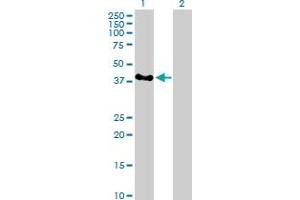 Western Blot analysis of SERTAD2 expression in transfected 293T cell line by SERTAD2 MaxPab polyclonal antibody. (SERTAD2 antibody  (AA 1-314))