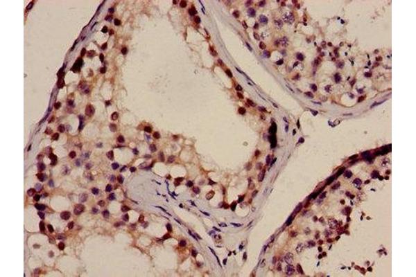 NELL2 antibody  (AA 511-637)