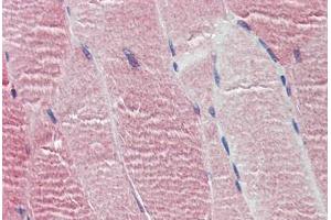 Human Skeletal Muscle: Formalin-Fixed, Paraffin-Embedded (FFPE) (HTR2C antibody  (AA 387-446))