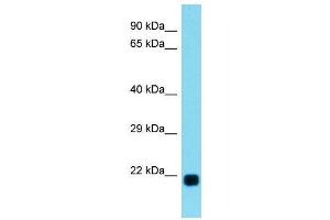 Host:  Rabbit  Target Name:  Lbx2  Sample Type:  Rat Heart lysates  Antibody Dilution:  1. (LBX2 antibody  (C-Term))