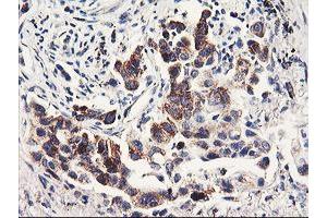 Image no. 6 for anti-Prenyl (Decaprenyl) Diphosphate Synthase, Subunit 2 (PDSS2) antibody (ABIN1500138) (PDSS2 antibody)