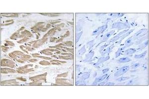 Immunohistochemistry analysis of paraffin-embedded human heart tissue, using BRP44L Antibody. (BRP44L antibody  (AA 11-60))