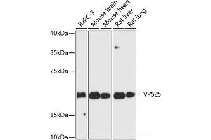Western blot analysis of extracts of various cell lines using VPS25 Polyclonal Antibody at dilution of 1:3000. (VPS25 antibody)