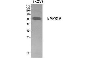 Western Blot (WB) analysis of SKOV3 cells using CD292 Polyclonal Antibody. (BMPR1A antibody  (Internal Region))