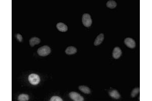 Immunofluorescent staining of A549 (ATCC CCL-185) cells. (MDM2 antibody  (AA 154-167))