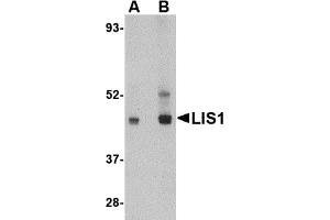 Western Blotting (WB) image for anti-Platelet-Activating Factor Acetylhydrolase 1b, Regulatory Subunit 1 (45kDa) (PAFAH1B1) (C-Term) antibody (ABIN1030486) (PAFAH1B1 antibody  (C-Term))