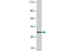 Western Blot detection against Immunogen (36. (DNMBP antibody  (AA 491-590))