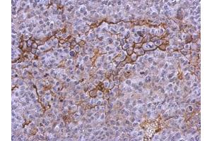 IHC-P Image Immunohistochemical analysis of paraffin-embedded PC13 xenograft, using CD41, antibody at 1:500 dilution. (Integrin Alpha2b antibody  (Internal Region))