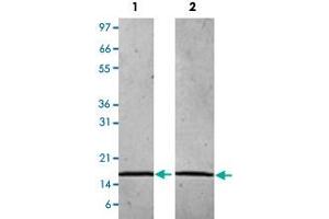 Lane 1: non-reducing conditions Lane 2: reducing conditions (Chemerin Protein)