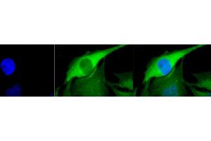 Immunocytochemistry (ICC) image for anti-Heat Shock Protein 70 (HSP70) antibody (ABIN361821)