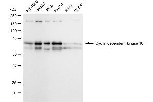 Western blotting analysis using Cyclin dependent kinase 16 antibody (ABIN7798208).