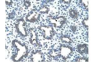 GNAS antibody was used for immunohistochemistry at a concentration of 4-8 ug/ml to stain Alveolar cells (arrows) in Human Lung.