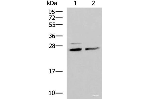 SNRPB2 antibody