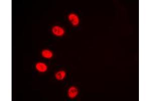 Immunofluorescent analysis of NR2F2 staining in HeLa cells.