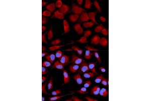 Immunofluorescence analysis of U2OS cell using PDHA1 antibody. (PDHA1 antibody)